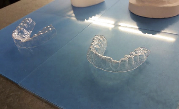 Projeto do aparelho dentário