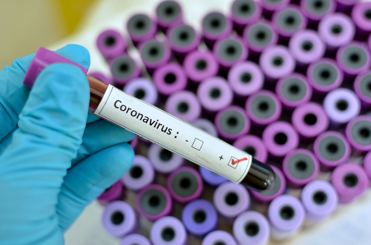 Número de mortes por coronavírus sobe para 10 no Piauí, diz Sesapi  - Imagem 2
