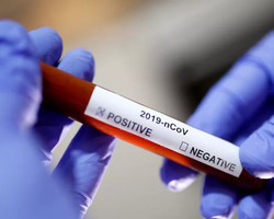 Coronavírus: Saiba por que algumas pessoas voltam a testar positivo