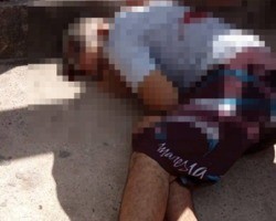 Jovem baleado na cabeça no bairro São Joaquim não resiste e morre no HUT
