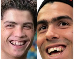 Veja os jogadores salvos pelos dentistas; Tevez, CR7, Ronaldinho e mais