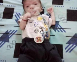 Bebê de 6 meses com problemas cardíacos morre no Sul do Piauí       