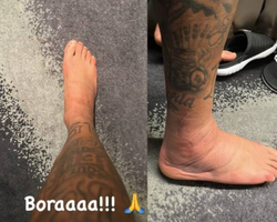 Em tratamento, Neymar posta foto de tornozelo direito bastante inchado