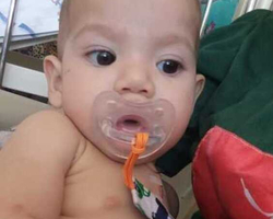 Bebê piauiense realiza cirurgia e família pede ajuda para recuperação