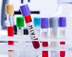 Teste com vacina contra HIV apresenta resultados positivos