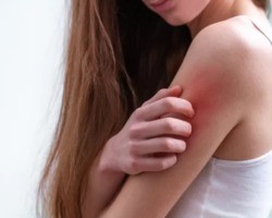 Conheça 6 alergias de pele bem comuns em humanos; saiba mais sobre elas
