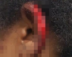Homem é preso após arrancar parte da orelha da esposa com mordida no Piauí