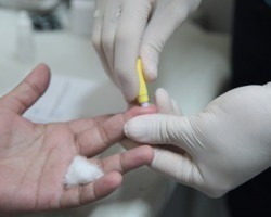 Julho Amarelo: Nova Ceasa realizará testagem de hepatite amanhã (20)