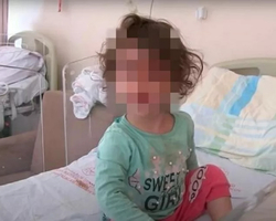 Menina de 2 anos mata cobra a dentada após ser atacada em casa