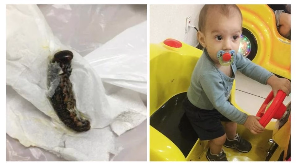Criança teria engolido lagarta, passou mal e morreu | FOTO: Reprodução