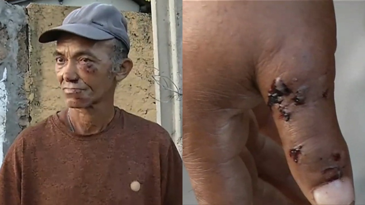 Idoso fica gravemente ferido após ser espancado por assaltante em Teresina (Foto: Rede Meio Norte)