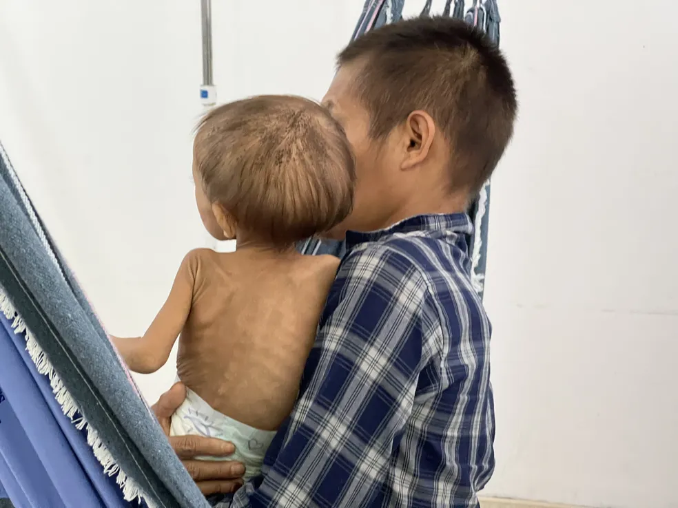  Criança com costelas aparentes no colo do pai Yanomami em hospital de Boa Vista — Foto: Caíque Rodrigues/g1 RR