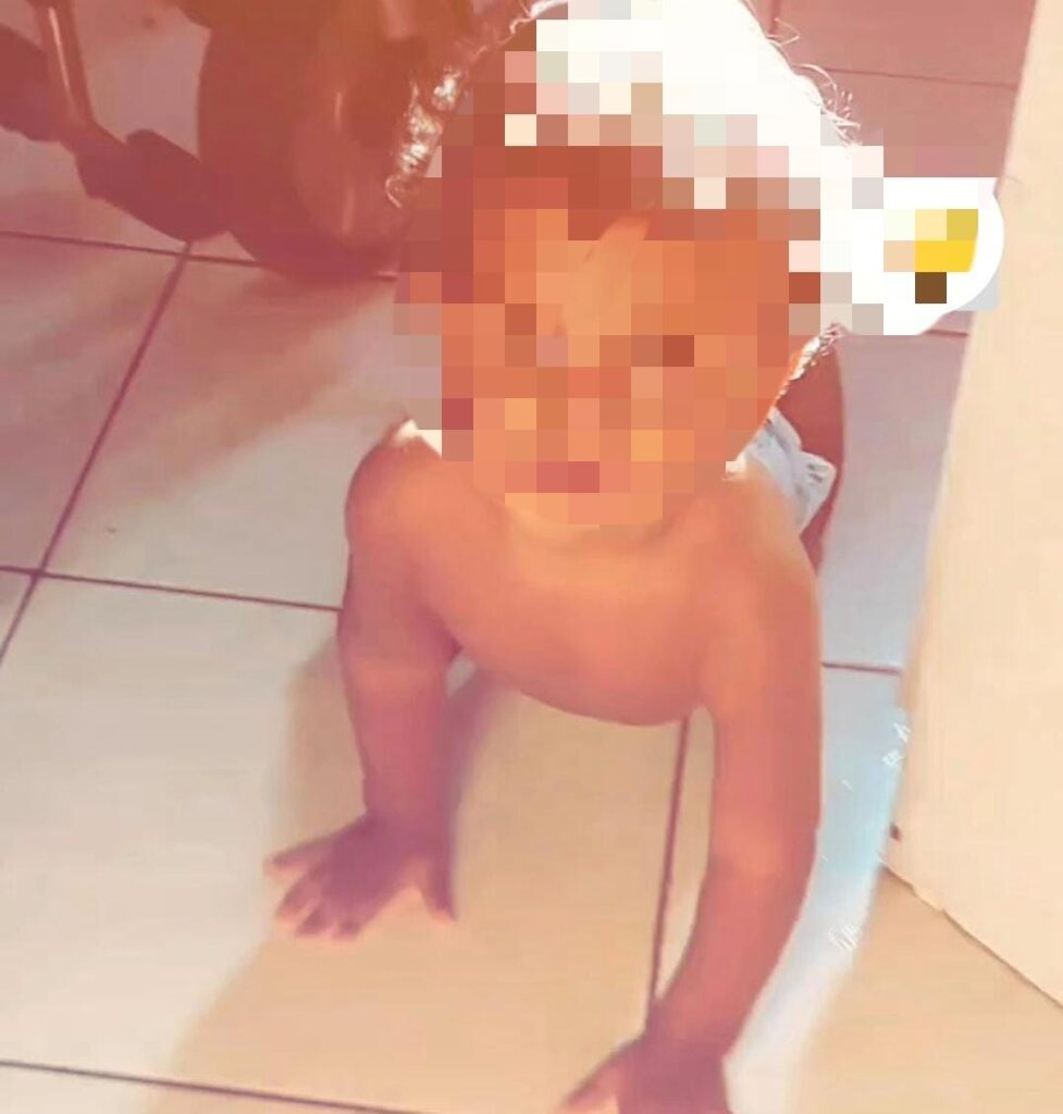 Pitbull mordeu a cabea de beb de 10 meses (Foto: Reproduo)