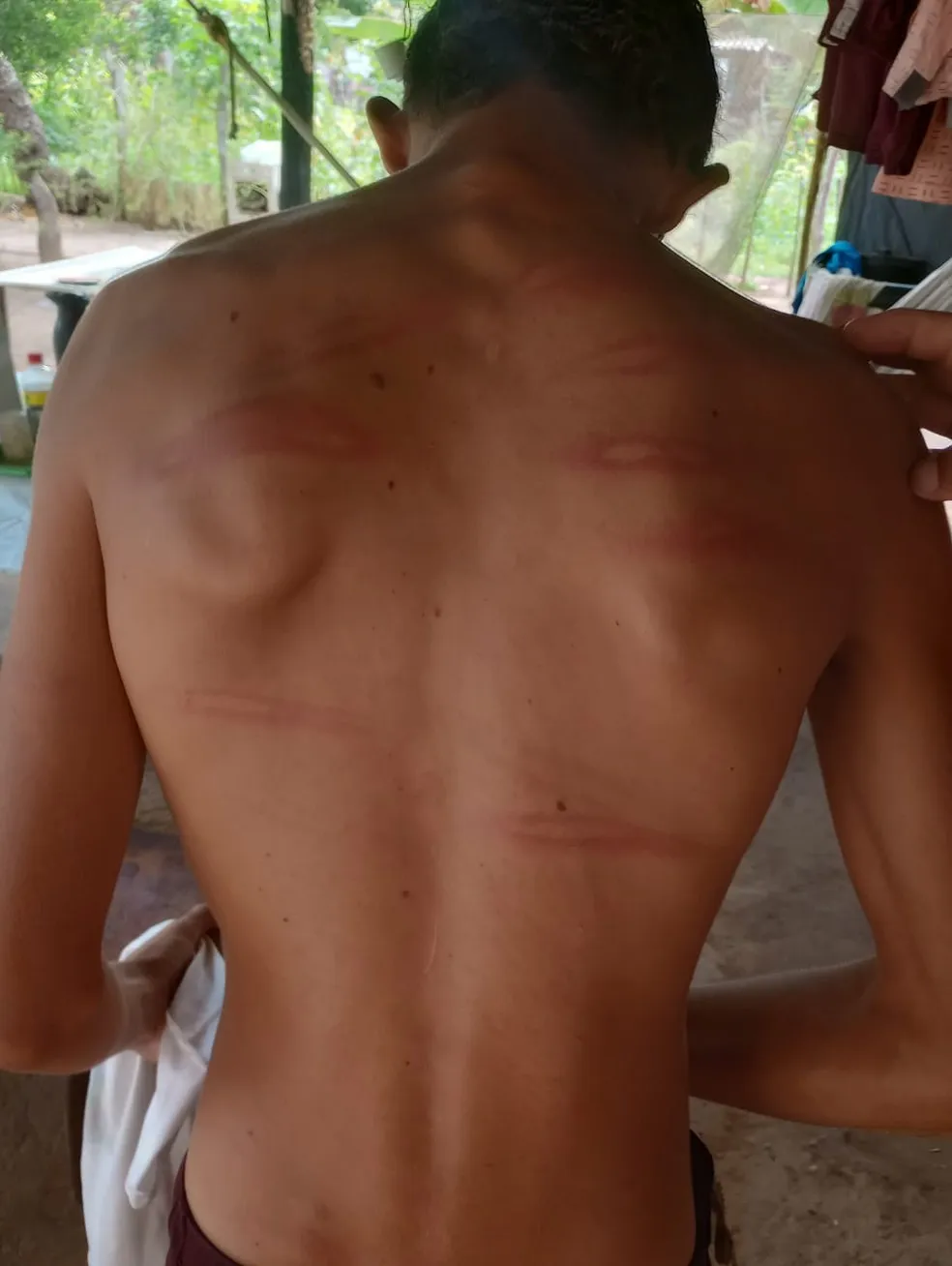Marcas das agressões ficaram no corpo do adolescente. — Foto: Divulgação / Polícia Civil