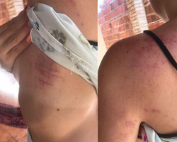 Mulher finge desmaio para ex-namorado parar de agredi-la no Ceará 