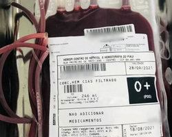 Laboratório do Hemopi identifica paciente com sangue raro no Piauí