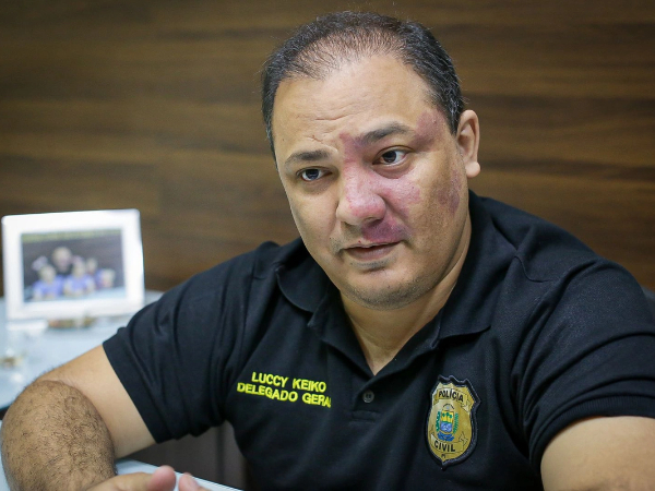 Delegado Luccy Keiko lamenta morte de policiais civis no Ceará 